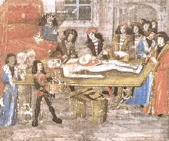 Leichensektion in der Handschrift der Grande Chirurgie des Gui de Chauliac, Bibliothèque Fac. Méd. Montpellier H 184 f°15v° (2. Drittel 15. Jh.)